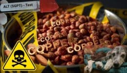 copper storage disease feature image